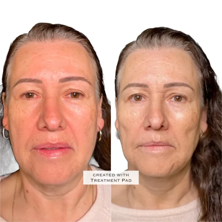 Patient result