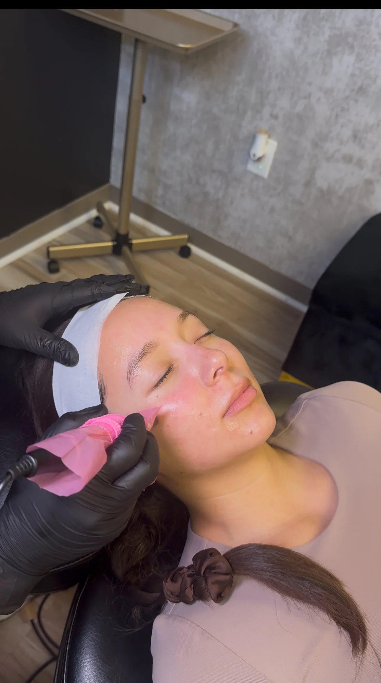 Tratamiento de microneedling con SkinPen y PRF en Revive Beauty Bar en Salinas