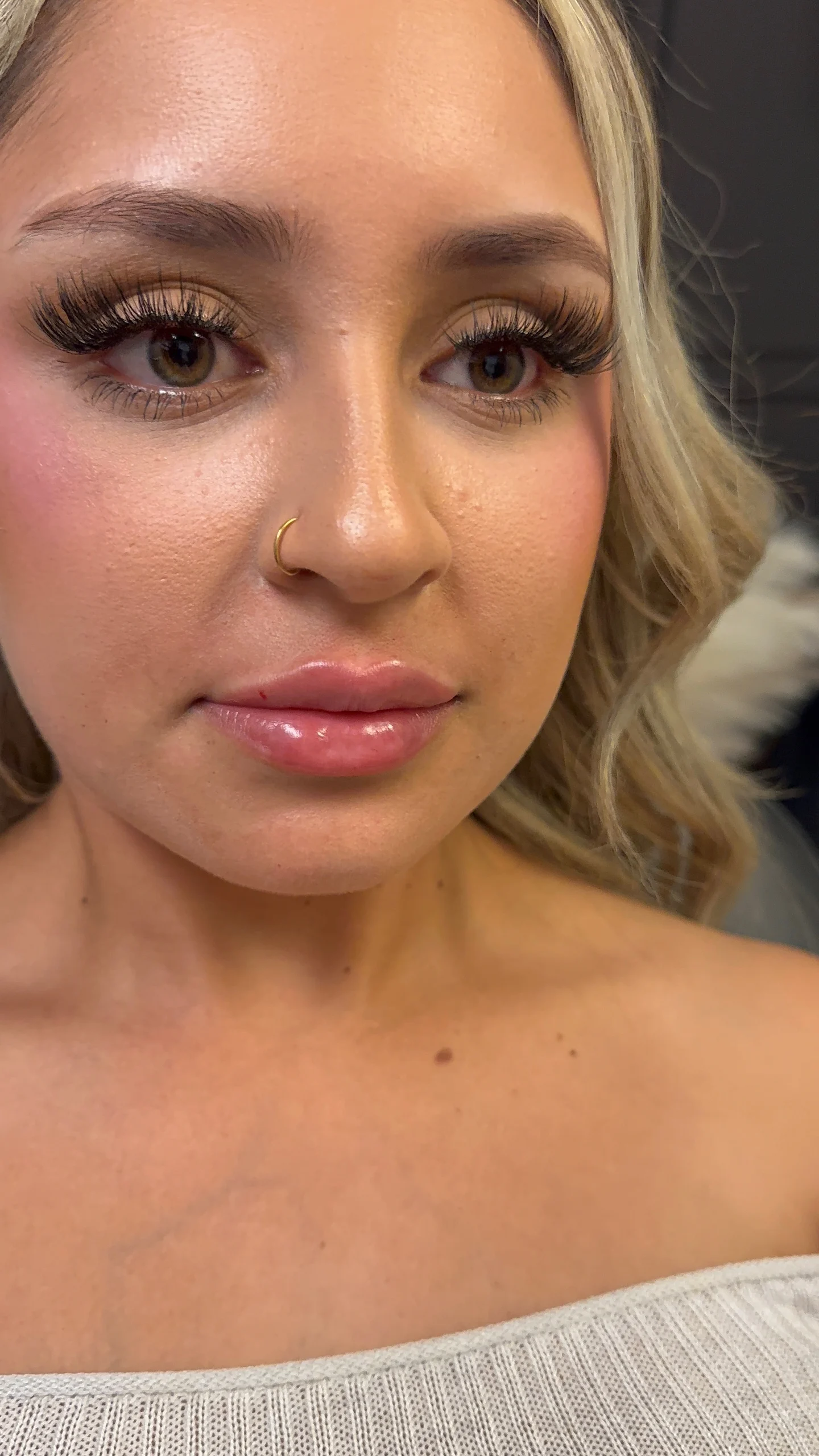 Primer plano de un resultado de relleno de labios de aspecto natural en Revive Beauty Bar en Salinas, CA