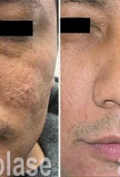 Rejuvenation2 - Revive Beauty Bar Aesthetics