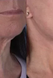 Revive Beauty Bar Aesthetics