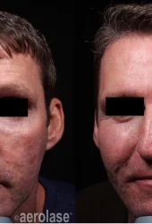 Skin Rejuvenation - Revive Beauty Bar Aesthetics