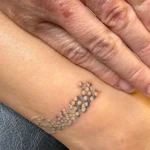 Laser Tattoo Removal (Remove Unwanted Ink)