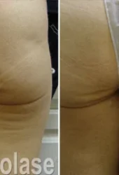 skin rejuvenation 3 -Revive Beauty Bar Aesthetics